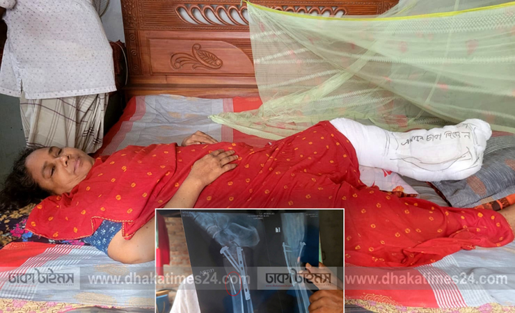 বনপাড়ার জাহেদা ক্লিনিকে রোগীর পায়ে ড্রিলের ফলা রেখেই সেলাই! পা হারানোর শঙ্কা
