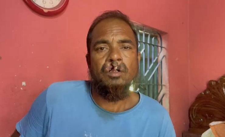 সালথায় আ.লীগ নেতাকে গ্রেপ্তার করায় বিএনপি নেতার দাঁত ভেঙে দেওয়ার অভিযোগ